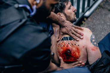 Preview: SAM® Chest Seal Thoraxverband, Ohne Ventil, 2 Stück – Ansicht 3
